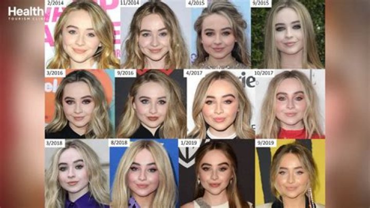 Did Sabrina Carpenter Get Work Done? A Closer Look At Her Transformation