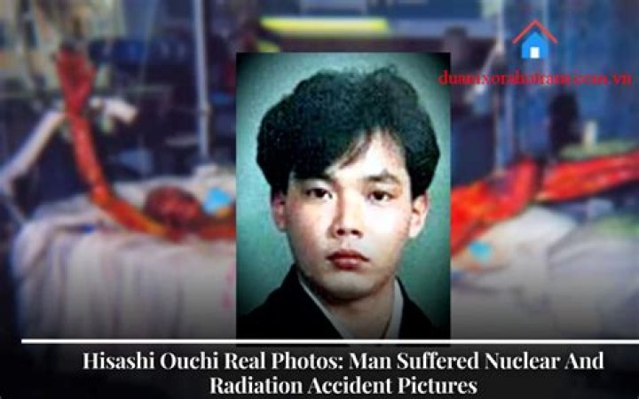 Hisashi Ouchi Real Photos Photograph Why Was He