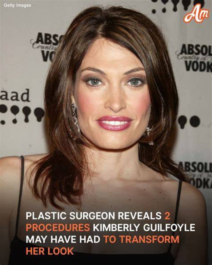 Kimberly Guilfoyle Before Image 2