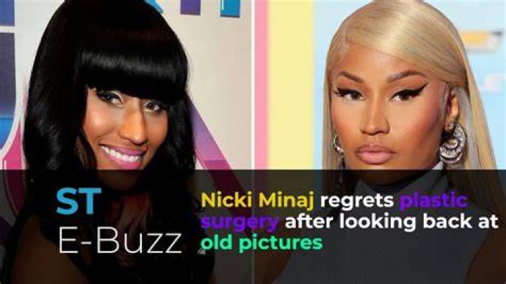 Nicki Minaj Regrets Plastic Surgery After Looking Back at Old Photos