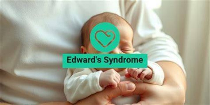 Understanding Edward Bluemel's Medical Condition And Its Impact On His Face