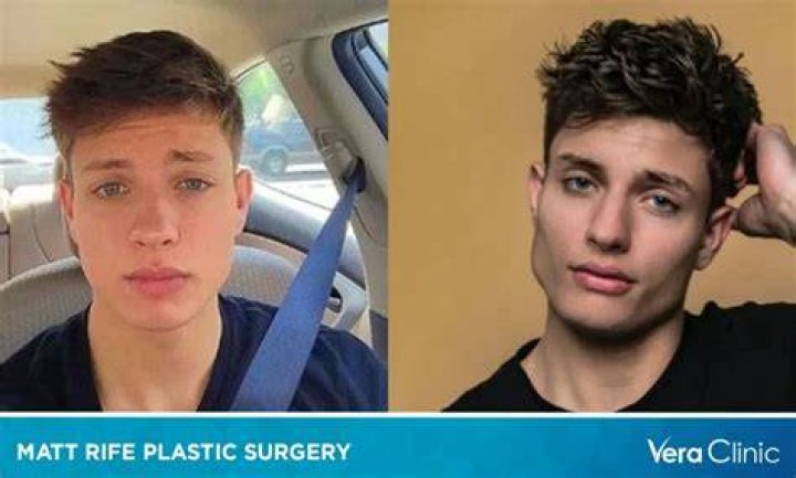 What Happened To Matt Rife When He Was Young, Before His Cancelation