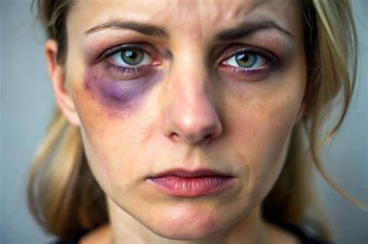 Woman with black eye mouths 'help me' to pizza delivery man; ex